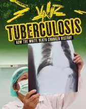 Tuberculosis: How the White Death Changed History