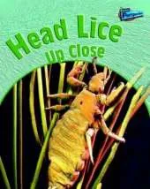 Head Lice Up-close