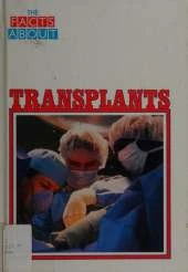 Transplants