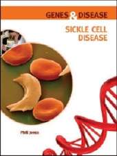 Sickle Cell Disease
