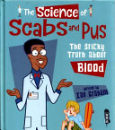The Science Of Scabs & Pus: The Slimy Truth About Blood