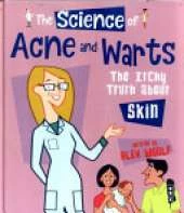 The Science Of Acne & Warts: The Itchy Truth About Skin