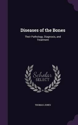 Diseases of the Bones: Their Pathology, Diagnosis, and Treatment