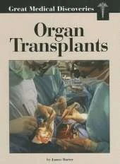 Organ Transplants