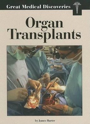 Organ Transplants