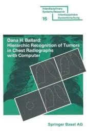 Hierarchic Recognition of Tumors in Chest Radiographs with Computer