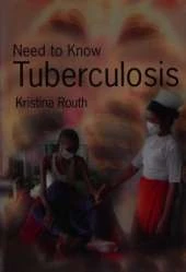 Need To Know: Tuberculosis Paperback