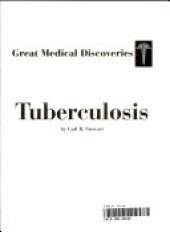 Tuberculosis