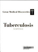 Tuberculosis